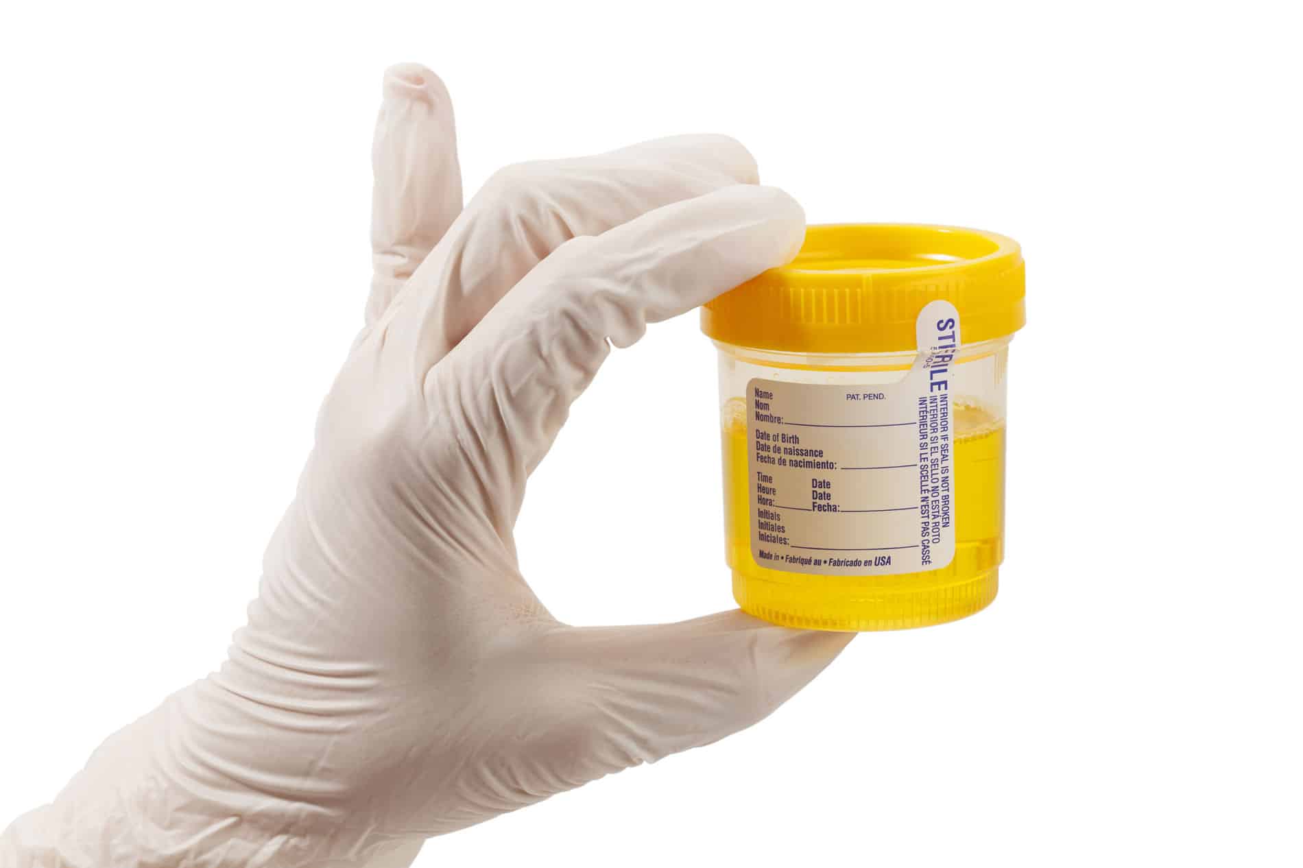 You are currently viewing Multiple Drug Testing Locations Provide Convenience