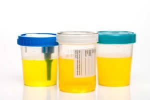 Read more about the article DOT Requires Random Drug Testing Program
