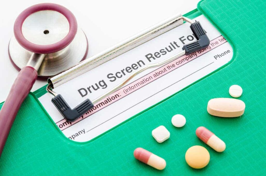 CDL Drug testing