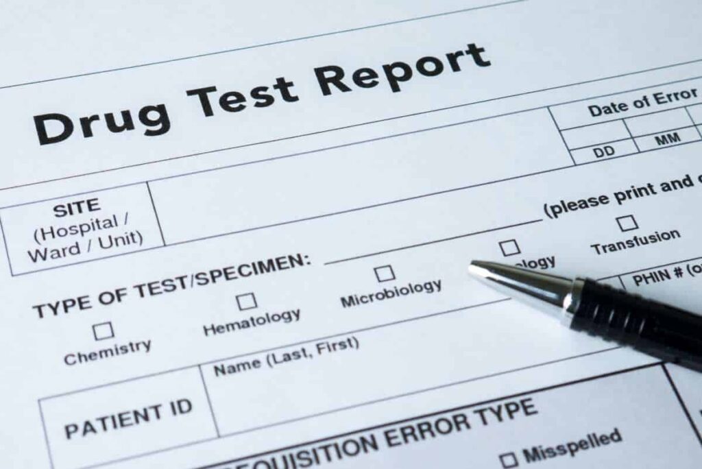 DOT pre-employment drug test