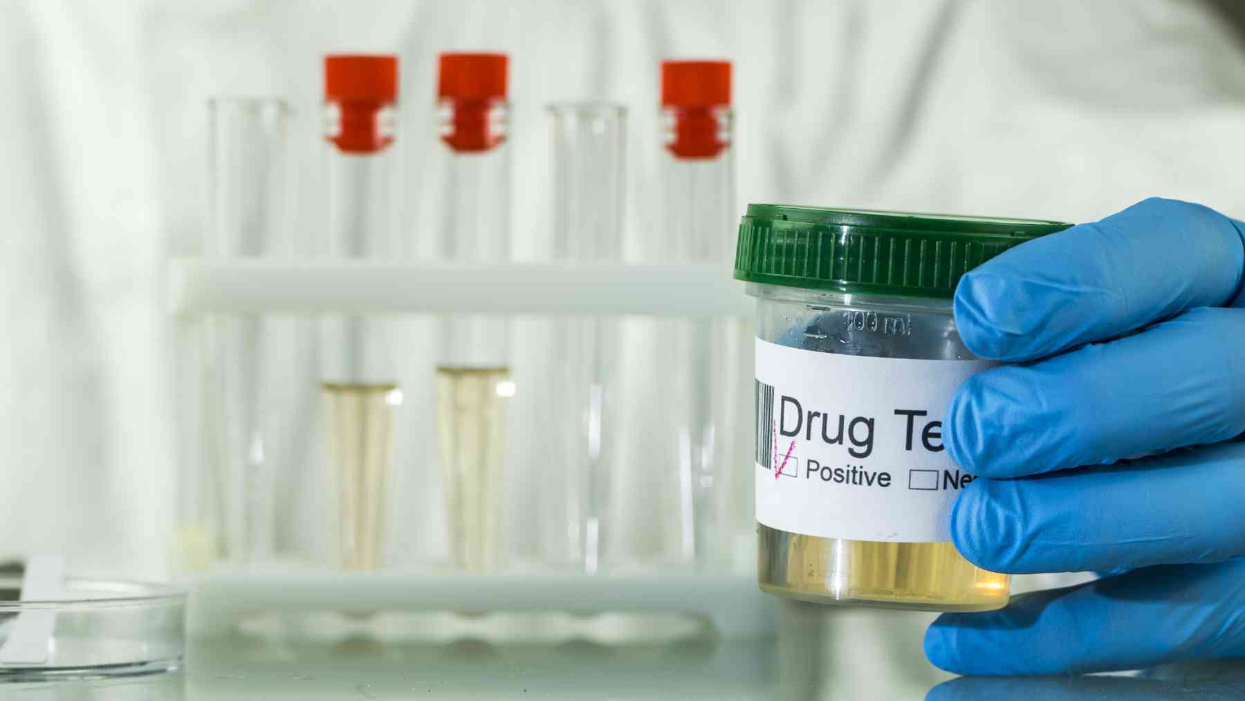 Read more about the article Consortiums fulfill requirement for random drug testing programs