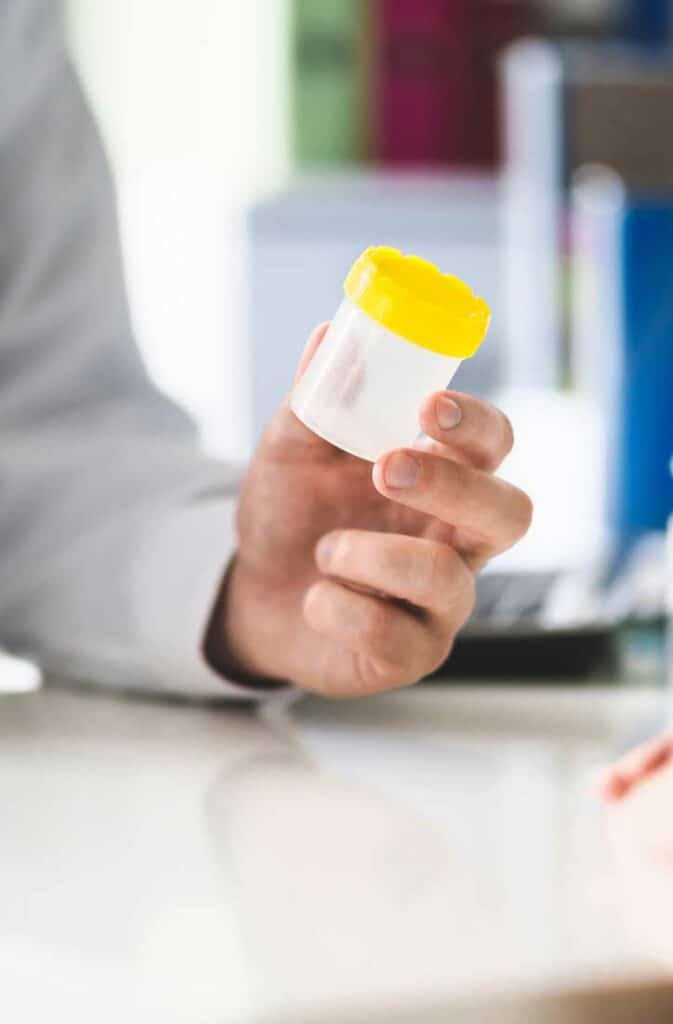 WDTC urine drug testing