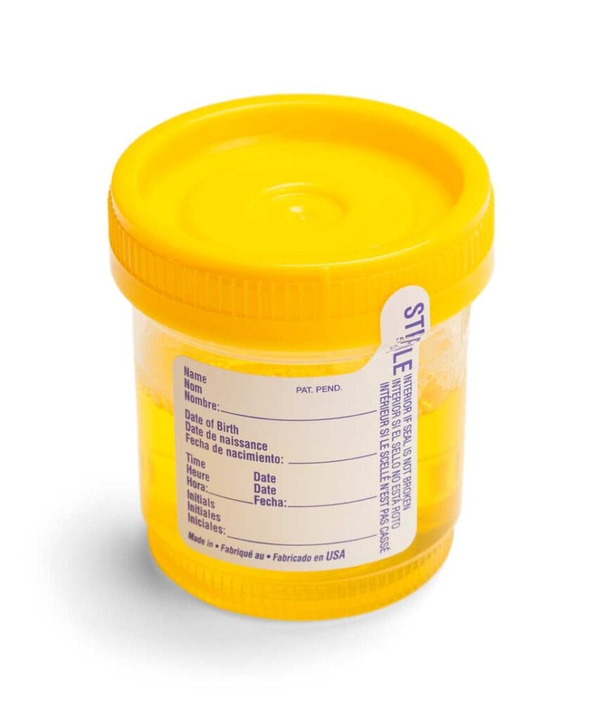 drug urine test yellow cup